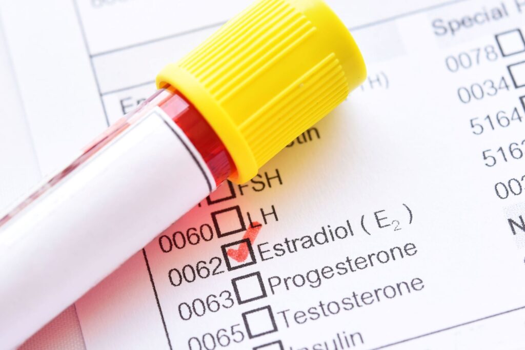 Blood test vial on top of chart with estradiol (estrogen) check marked