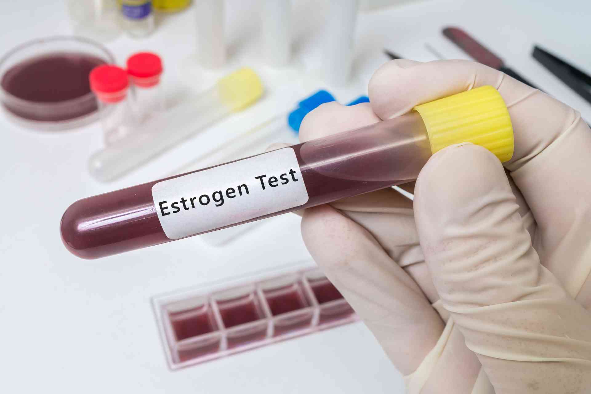 Estrogen Test