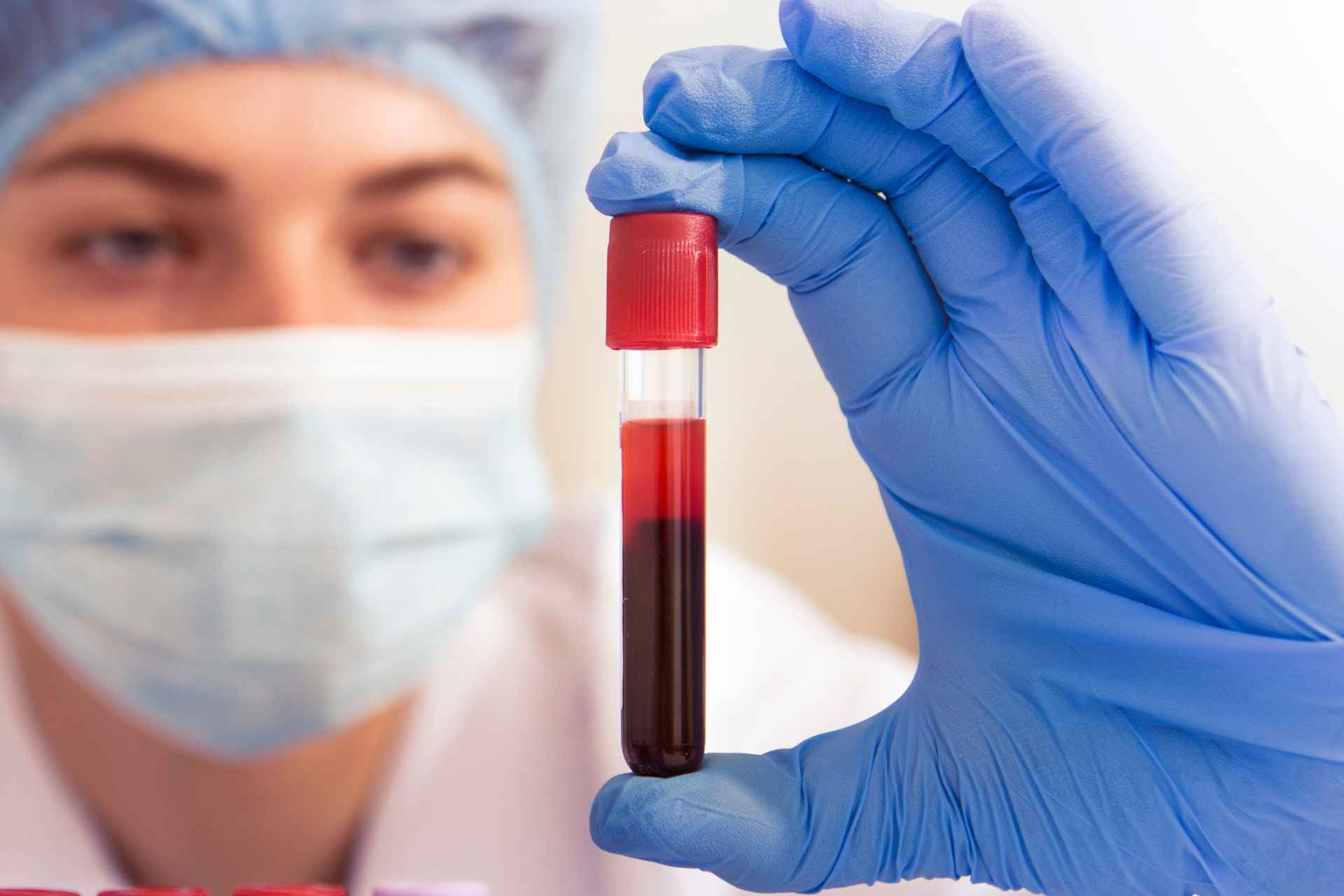 Menopause Hormone Blood Test